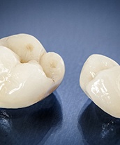 Two ceramic dental crowns