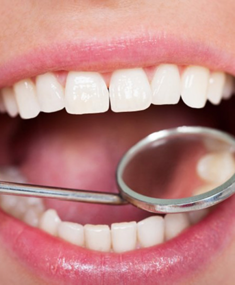 Teeth are examined with dental mirror