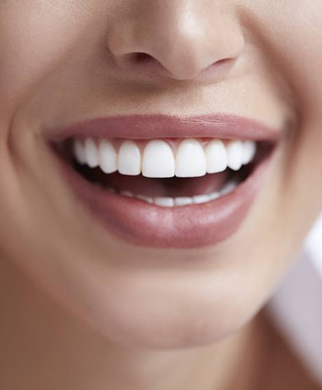 Close up of flawless smile after teeth whitening