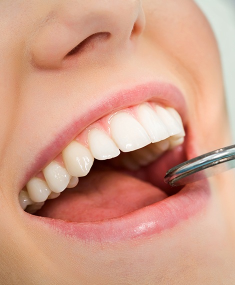 Patient receiving deep teeth cleaning in the dental office