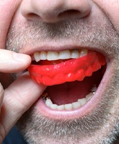 man putting a red mouthguard in his mouth