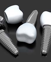 Three dental implant posts with abutments and crowns