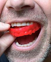 Man putting a red mouthguard in his mouth