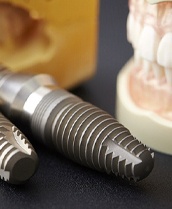 a closeup image of dental implants