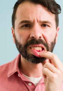 Man pointing to his gums