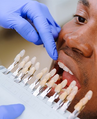 Closeup of blue-gloved hands holding shade-guide to man’s teeth