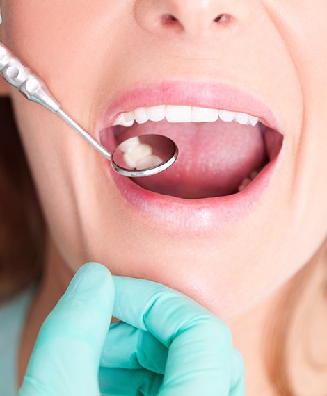 Dentist checking the mouth of a patient with a dental mirror