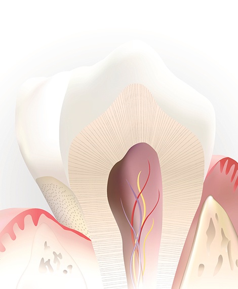 Animated inside of a healthy tooth that doesn't need root canal therapy