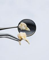 Forceps holding extracted tooth in front of mirror