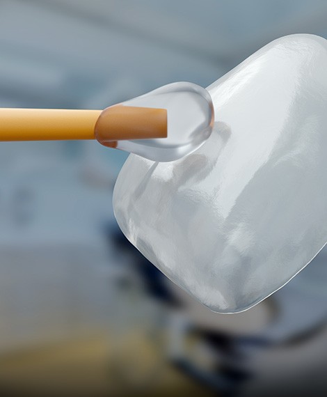 Animated dental veneer being placed over the front of a tooth