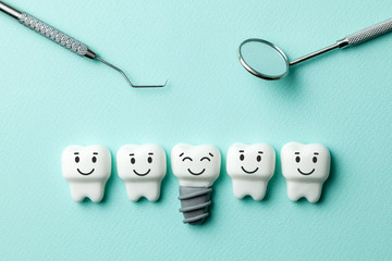 Illustration of dental implant